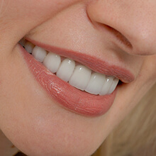 Closeup of woman's flawless smile