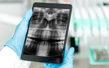 Panoramic dental x-ray on tablet
