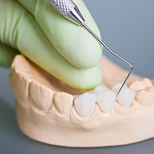 Model of teeth with dental bridge