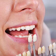 Closeup of teeth compared to color chart