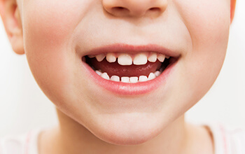 Closeup of child's teeth