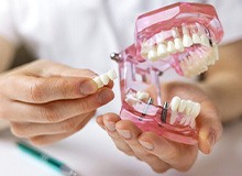 a dentist holding a model of dental implants