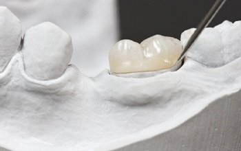 A metal-free dental crown