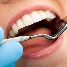Closeup of teeth during dental evaluation