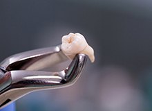 Closeup of dental tool holding tooth