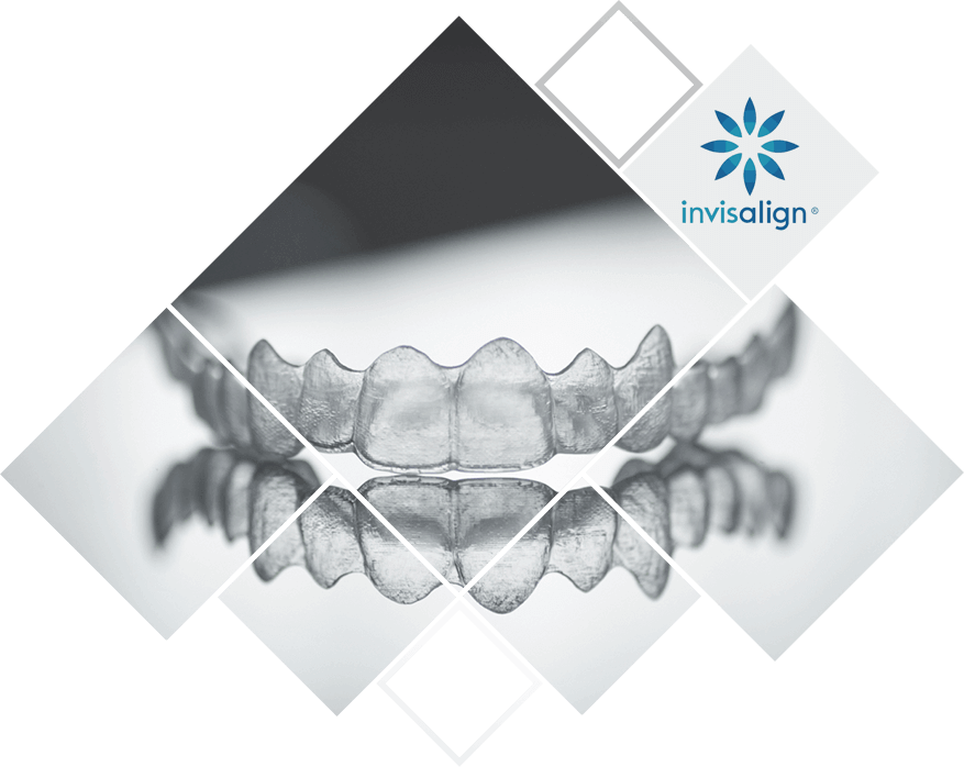 Invisalign alignment tray on table