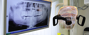 Panoramic dental x-ray on computer screen